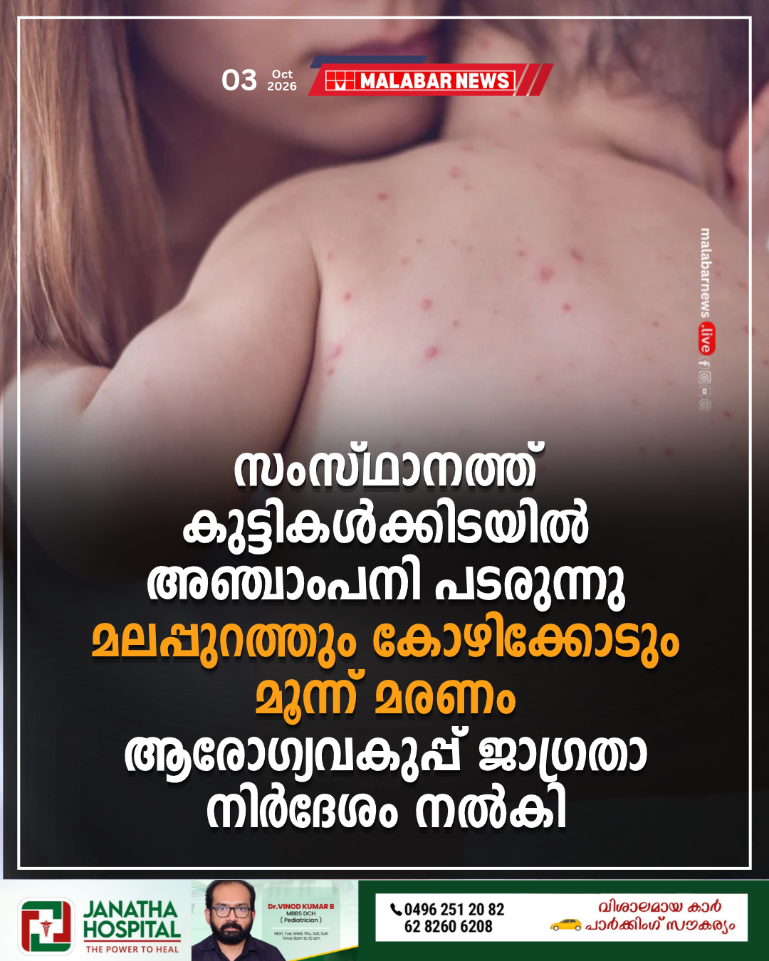 സംസ്ഥാനത്ത് കുട്ടികൾക്കിടയിൽ അഞ്ചാംപനി പടരുന്നു; മലപ്പുറത്തും കോഴിക്കോടും മൂന്ന് മരണം, ആരോഗ്യവകുപ്പ് ജാഗ്രതാ നിർദേശം നൽകി