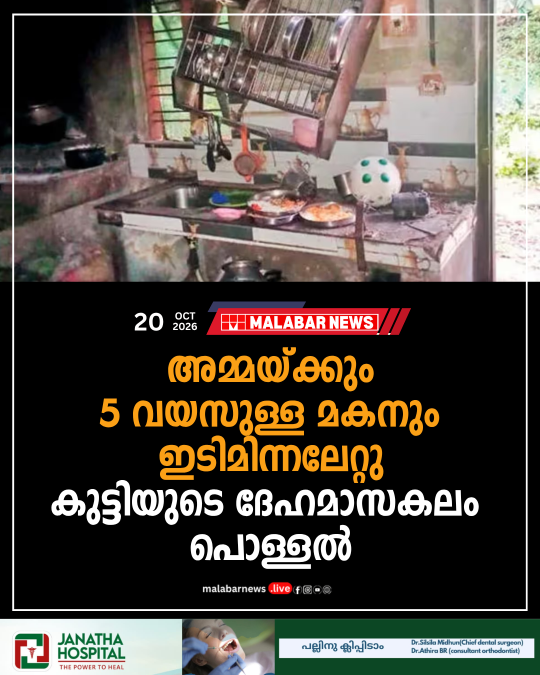 അമ്മയ്ക്കും 5 വയസുള്ള മകനും ഇടിമിന്നലേറ്റു, കുട്ടിയുടെ ദേഹമാസകലം പൊള്ളൽ; സംഭവം കൊല്ലം കുണ്ടറയിൽ